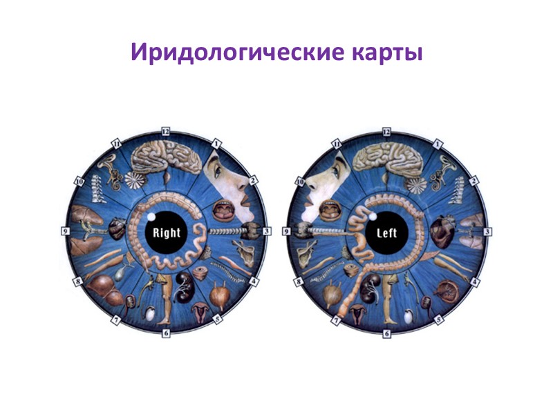 Иридологические карты